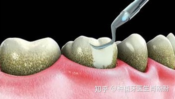 口腔出血是什么原因