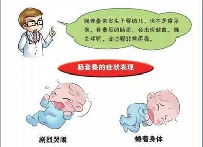 宝宝肠套叠症状