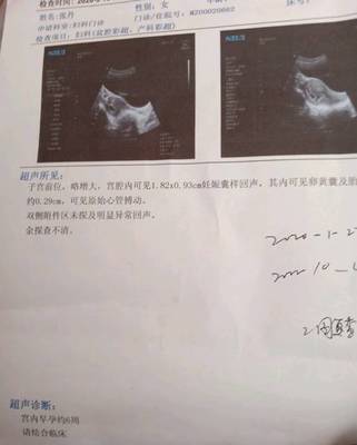 孕吐越厉害胎儿越稳定