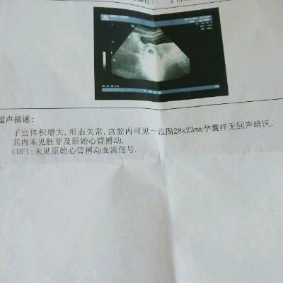 怀孕空囊的原因
