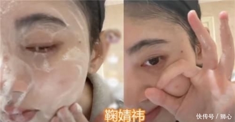 痘痘好了颜值确实提升不少