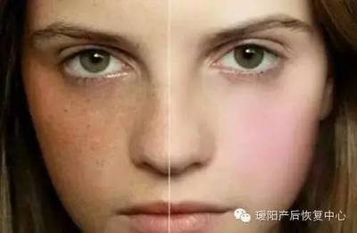 产后身上长斑怎么回事