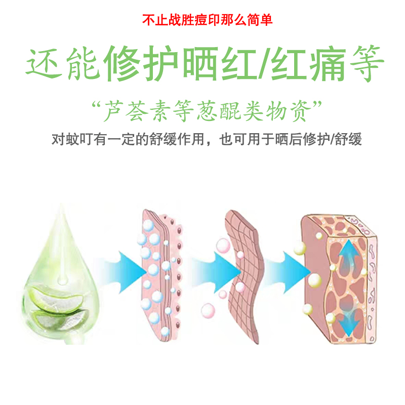 芦荟胶能修复痘印吗