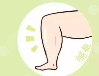 吸脂瘦腿效果如何