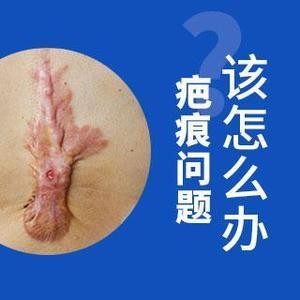 凸疤痕
