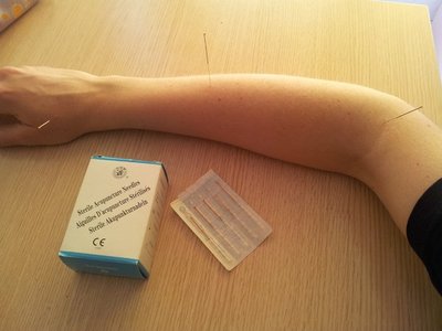 怕金病帕金森怎么治疗