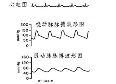 请问正常脉搏是多少