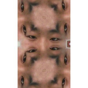 合肥祛斑推荐艺兴
