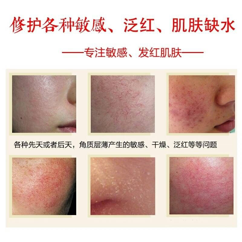 脸部角质层增厚