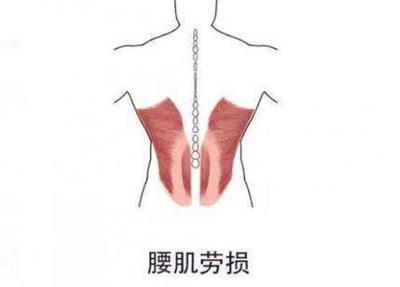 右腰里面疼是怎么回事