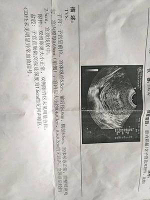 白带淡粉色是怎么回事