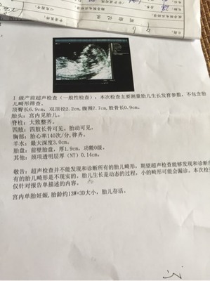 怀孕6个多月胎动少正常吗