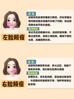 脸上的痘痘是什么原因分析