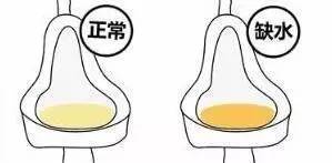 小便发浑是怎么回事