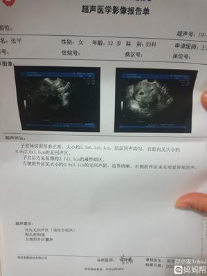 怀孕40天孩子多大
