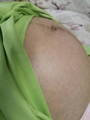 怀孕腰变粗
