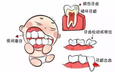 一岁宝宝牙龈出血