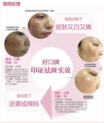 夏季美容院拓客方案