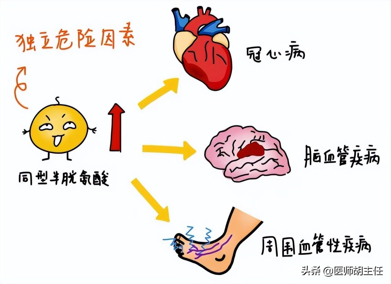 脑梗怎么治疗