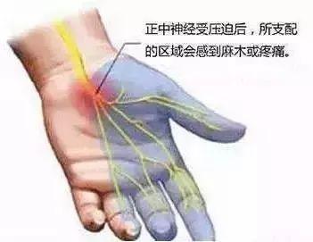 手脚麻涨是怎么回事