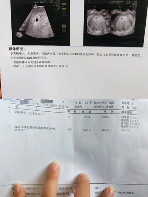 月经前三天会怀孕吗