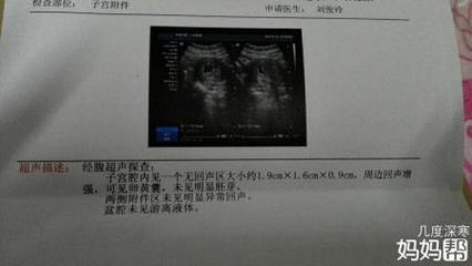 怀孕40天能看出男女吗