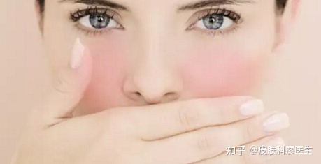 红痘痘怎么治