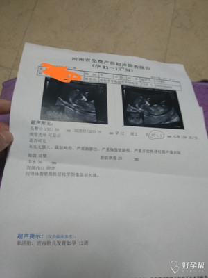 怀孕三个月怎么看男女
