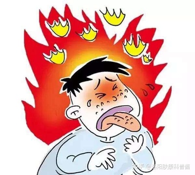 为什么上火会长痘痘
