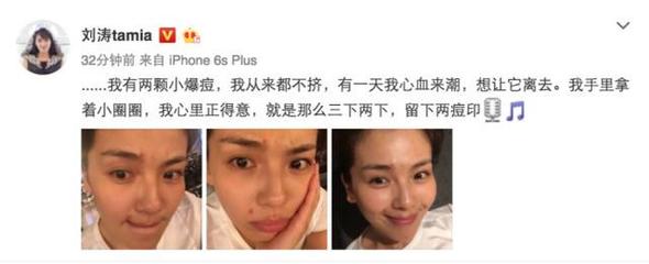 痘痘不挤会有黑色的印