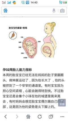 32周胎儿