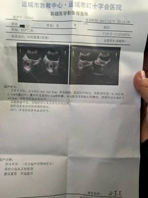 怀孕6周彩超图片