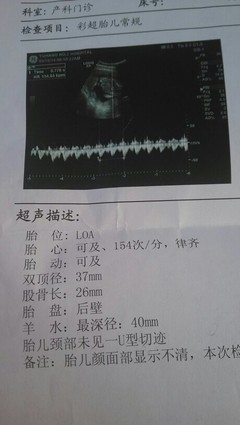胎儿一般多久有胎心
