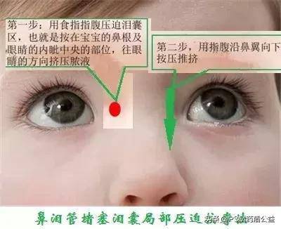 眼睛泪管堵塞怎么治疗
