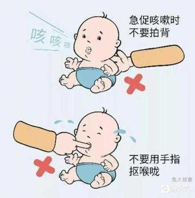 一岁宝宝咳嗽严重怎么办