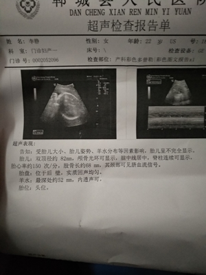 孕35周几个月