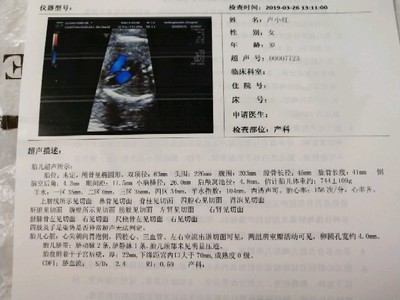 四维彩超是几个月做