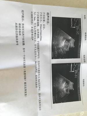 流产多久能怀孕