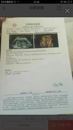 做完人流多久能怀孕