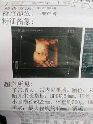怀孕6个月胎儿图片