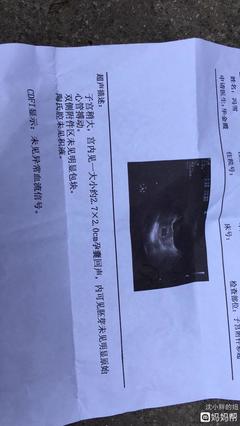 宝宝几周有胎心