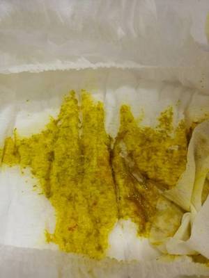 六个月宝宝大便有血丝