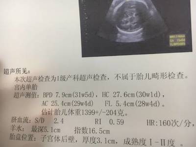 孕三十三周是几个月