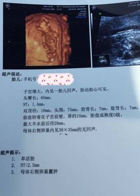 胎儿几个月有胎动正常