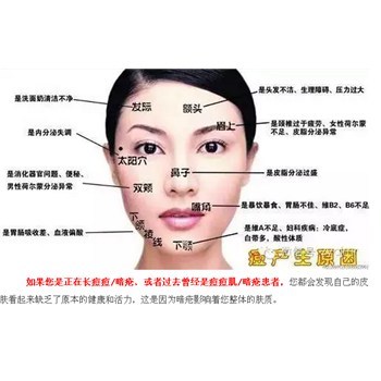 太阳穴上面长痘痘怎么回事