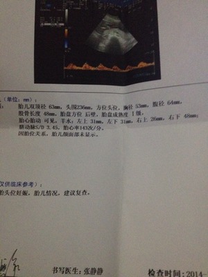 六个月胎儿双顶径标准