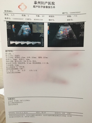 孕27周是几个月