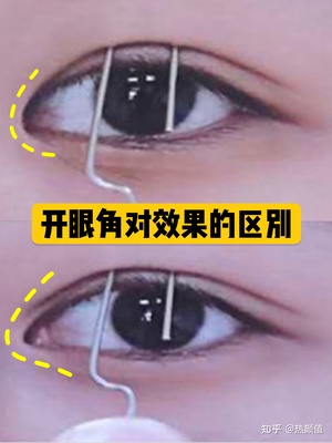 开眼角下至