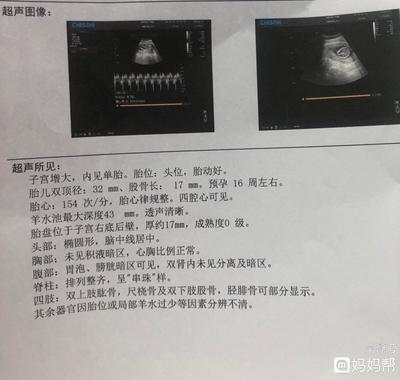 胎儿几个月有胎动正常