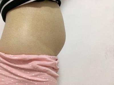 宝宝肚子上有一条竖线